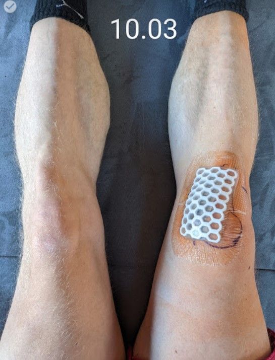 Knie1003.jpg