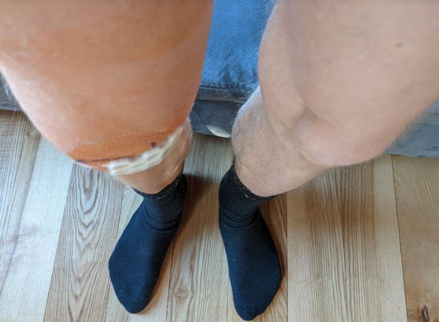 Knie1003anders.jpg